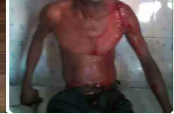 Many Injured As Armed Attackers Storm Community In Rivers (Graphic Photos)